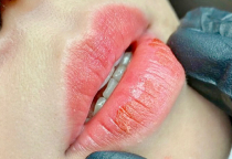 Khóa học phun môi thẩm mỹ – Công nghệ mới, kỹ thuật hiện đại 2025